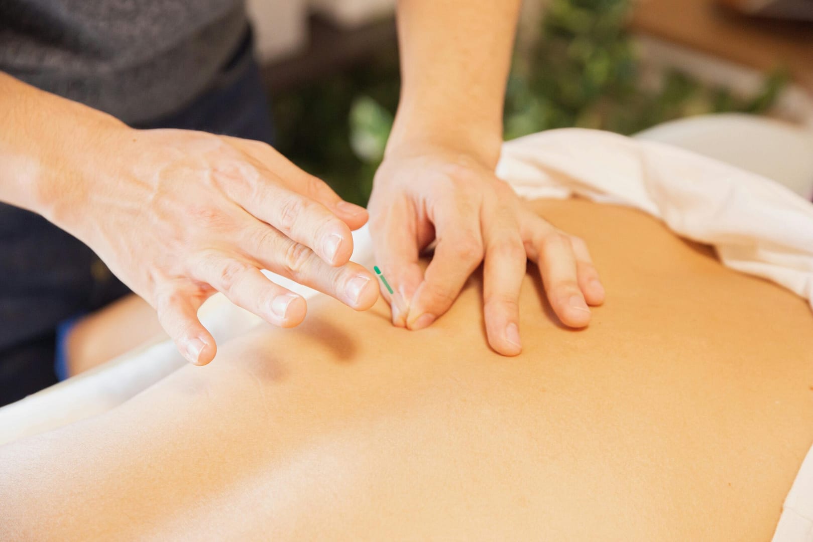 acupuncture near me
